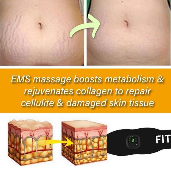 SmartFitness Fat & Cellulite Reduction EMS Belt