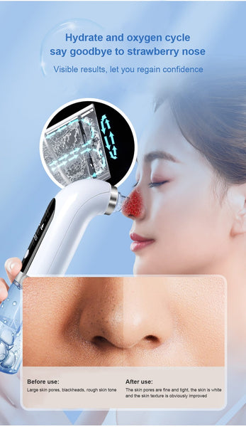 Hydro Derma Vacuum Suction Facial Cleaner